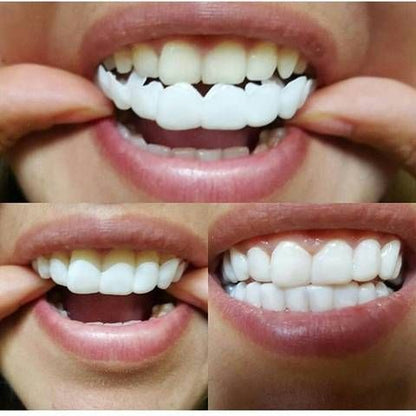 Instant Smile Premium, Natural Looking Veneers